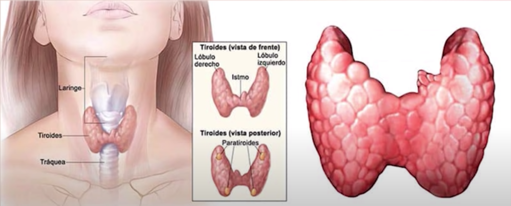 O que fazer com o Nódulo na Tireoide?